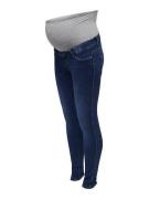 ONLY MATERNITY Zwangerschapsjeans OLMROYAL LIFE SK MBD JEANS DNM NOOS