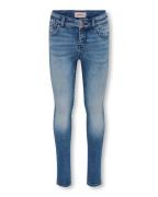 Only Jeans 15291377