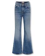 Only Jeans 15327051 kogjuicy
